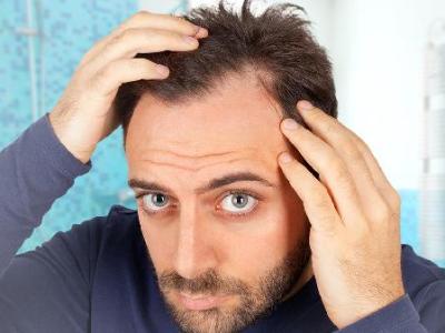 癌症患者最怕的“掉头发”，其实第几周才开始？这3件事提前做，脱发没那么可怕