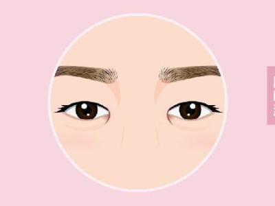 天生肿眼泡可以被按摩消除吗