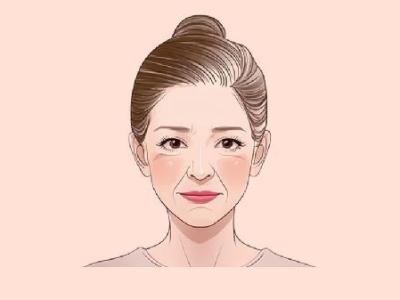 割眼袋能去除眼下的细纹吗