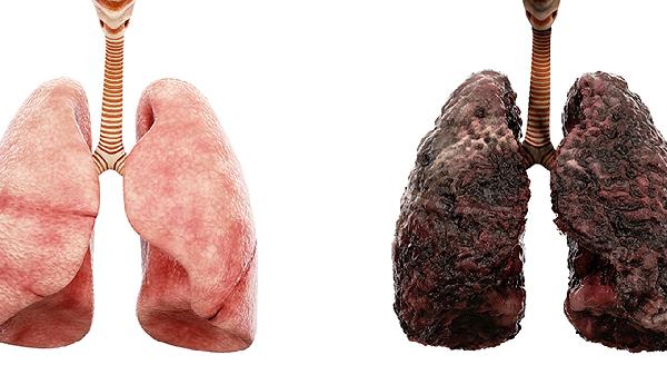医生调查发现:癌症患者每天睡午觉,不出半年,或有这6大变化?-易网健康<a href=/jkys/ target=_blank class=infotextkey>养生</a>网 医生调查发现:癌症患者每天睡午觉,不出半年,或有这6大变化?