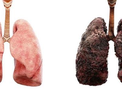 医生调查发现：癌症患者每天睡午觉，不出半年，或有这6大变化？