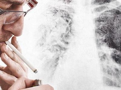 老年人要戒烟吗？医生：过了 65 岁以后，戒烟前要注意这 5 件事