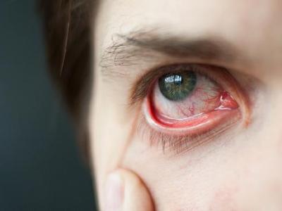 红眼病恢复后视力疲劳能恢复吗
